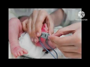 Hot topic! AAP update on neonatal heart disease screening #nicu #neonatology