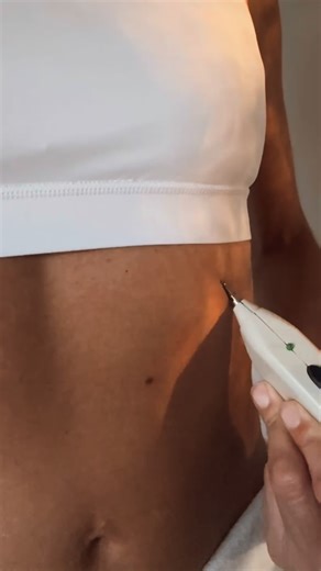 Teresa Santana ~ Escuela Natur on Instagram: "Te voy a decir algo... muchas personas tienen el Pointer pero lo usan sin un método. O no entienden bien cómo utilizarlo. Y eso no solo hace que no funcione, hace que te frustres y no aproveches su potencial o que te pases de estimulación. ✨Por eso he creado el primer curso con este dispositivo Meridianos & Pointer Excel II: Reset del Sistema Nervioso. Te enseño: cómo encontrar puntos, cómo ajustar intensidad y frecuencia sin liarla, y cómo aplicar u