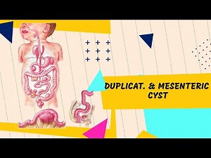 15 Duplication & Mesenteric cyst