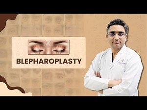 Lower and Upper Blepharoplasty Eyelid Surgery Procedure and Treatment Guide