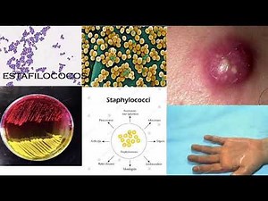Infecciones con estafilococos