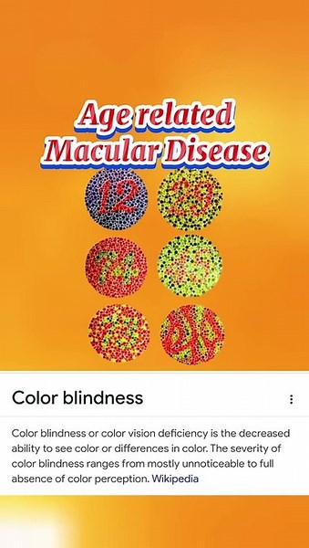 Multiple Human Eye 👁️ Problems