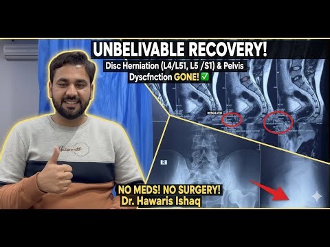Unbelievable recovery disc herniation L4/L5, L5/S1 and pelvic dysfunction.