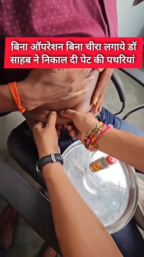 2M views · 13K reactions | वैद जी के पथरी निकालने का तरीका है एकदम अनोखा  | Social World | Facebook