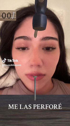 Forehead Tapping Technique for Relaxation