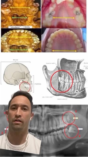 1.6K views · 21 reactions | Crooked teeth don’t happen via fate, they...