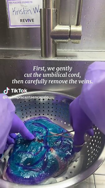 First, we gently cut the umbilical cord, then carefully remove the veins. This part of the process invites us to pause and truly appreciate the incredible uniqueness of the placenta—the place your baby once lived. It’s a reminder of where life began, and a reflection of all the strength and nourishment your body provided. This isn’t just an organ—it’s something your body created with purpose, care, and love. And now, it holds the potential to support, replenish, and heal you as you begin this ne