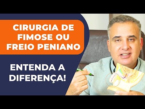 CIRURGIA DE FIMOSE (POSTECTOMIA) E CIRURGIA DE FREIO PENIANO (FRENULOPLASTIA) - ENTENDA A DIFERENÇA