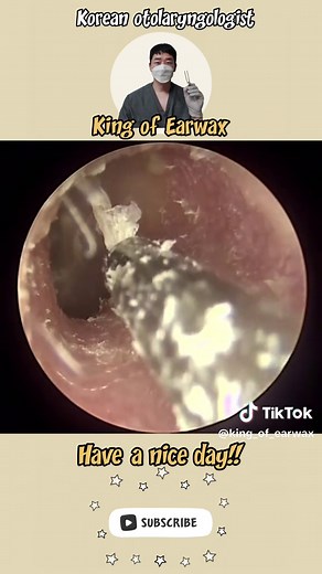 Effective Earwax Removal Techniques You Need to Know