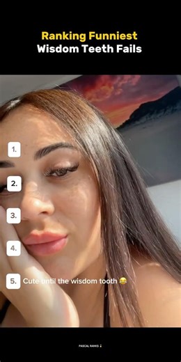 Ranking Funniest Funniest Wisdom Teeth Fails🦷#shorts