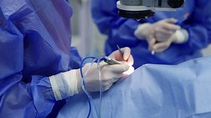 clip-1065840565-patient-during-ophthalmic-surgery-hands-ophtalmology ...