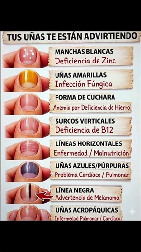 ¿Qué dicen tus uñas de tu salud? 💅⚠️