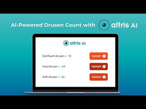 Drusen on OCT: AI-Powered Count