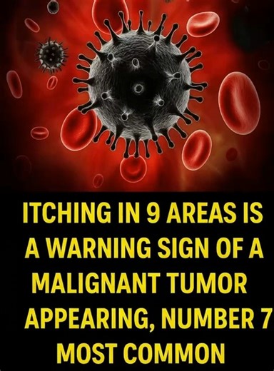 Itching in 9 Areas: A Warning Sign of Malignant Tumors, Number 7 Is the Most Common 👇👇🥸 | K Line Global