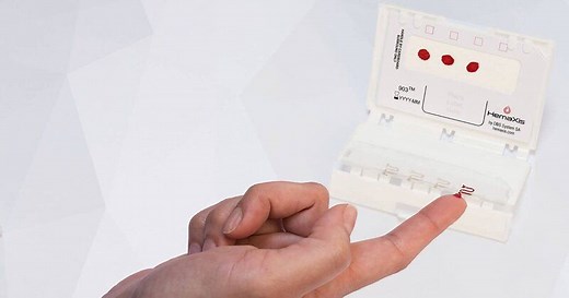 Quy trình thực hiện xét nghiệm đường máu mao mạch