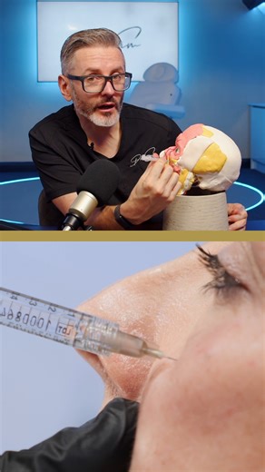 Dr Tim Pearce on Instagram: "✨ Cheek injections are considered safer, but anatomy still matters. We often inject needle on bone in the cheek, which helps reduce risk. Still, it’s essential to know what structures sit nearby. 🧠 Key anatomy points: The transverse facial artery sits around 17 mm inferior to most cheek injection points Occasionally, a small vessel may exit a foramen on the malar bone The temporal artery lies far lateral and is rarely encountered in medial cheek work ⚠️ Risk increas