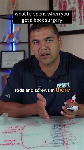 what a back surgery for lower back pain does