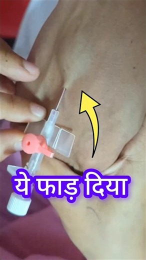 IV Cannulation
