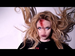 HOW I SPLIT MY HEAD OPEN (Storytime With Pictures!)