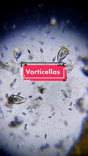 ciliados vorticellas #microscopiocasero #microscopio #casero #protozoos #ciliado #vorticella