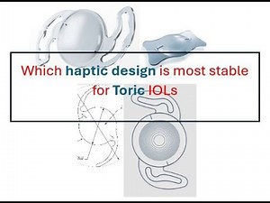 Best TORIC IOL haptic designs for rotational stability (follow quickguide.org)