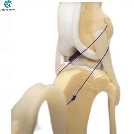 Lateral Suture Technique Dog Knee Surgery Veterinary Orthopedic InstrumentsTPLO TTA ACL Repair Artificial Ligament Suture