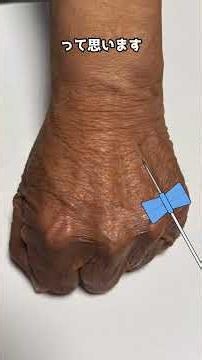 Which veins to choose on the back of the hand: How site selection differs between blood draws and...