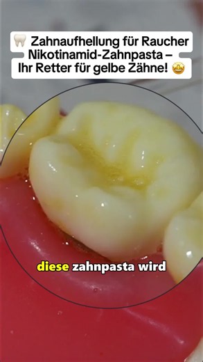 Mal ehrliche:Du putzt seit Jahren deine Zähne-und sie sind immer noch gelb?Dann hast du eindeutig die falsche Zahnpasta benutzt.clx#aufhellung #zahnpasta#mundgeruchMalzähne#mundgeruch wwf