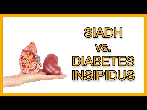 SIADH vs. Diabetes Insipidus