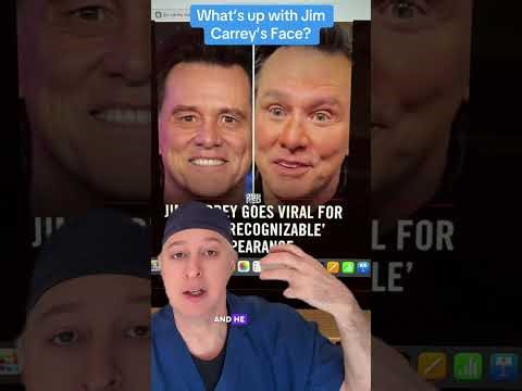 What’s up with Jim Carrey’s face?