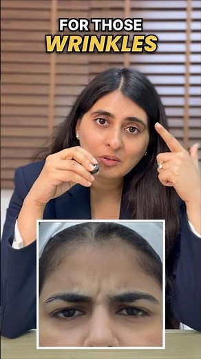 Botox for Upper Face | How Botox Actually Works | Botox Treatment in Delhi | Botox for Anti Aging