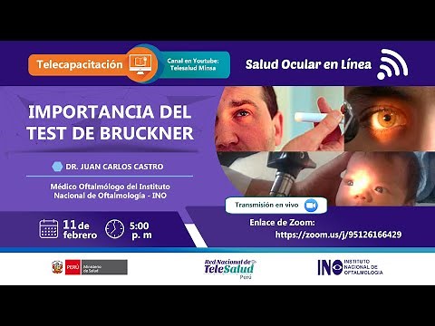 CLAVES Y ESTUDIO DEL EXAMEN DE REFLEJO DE OJOS - TEST DE BRUCKNER