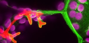 Research shows first land plants were parasitised by microbes