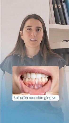 ¿Cada vez MÁS DIENTE Y MENOS ENCÍA? SOLUCIÓN✅RECESIÓN GINGIVAL #recesiongengival #enciasretraidas