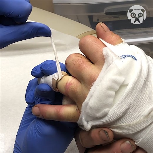 Amazing technique to remove a stuck ring | Crafty School