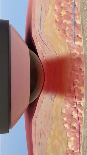 Goodbye MRI? This New 3D Color Scan Changes EVERYTHING!