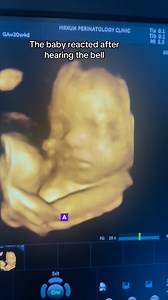 7.1K reactions · 327 shares | A grimace from a 30-week fetus during a 4D ultrasound after hearing a bell likely means:• 易 The fetus is neurologically developed enough to react to sound.•  The grimace shows facial muscle coordination and sensory response.•  It’s a normal reflex—It’s usually a healthy sign of development #pregnancy #prenatal #ultrasound #4d | Yen Dayres | Facebook