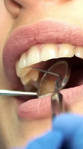 Dental Stem Cells 😁 Could Help Us Regrow Teeth, New Study Suggests