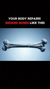 77K views · 1.1K reactions | When a bone breaks, the healing process...