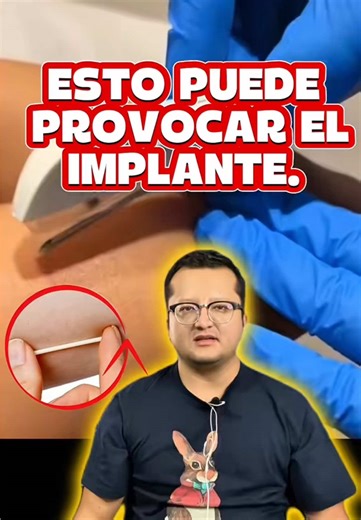 Implantes dentales: ¿Riesgos y beneficios?