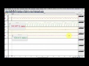 Using Labchart to detmine multiple respiratory parameters from a single spirometry trace