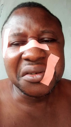 ils m'ont frappé encore 🤔🤔🤔🤔