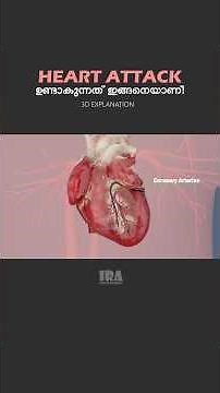 Heart Attack Explained in 3D | Causes, Symptoms & Treatment (Animated Medical Video)