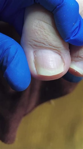 Indulge in Self-Care with a Perfect Pedicure