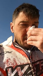 😢 A tough moment for James Hiller as he's forced to withdraw from the race after a heavy crash and a broken nose. Sensitive souls, look away. Get well soon James. 💪 #Dakar2025 | Dakar Rally