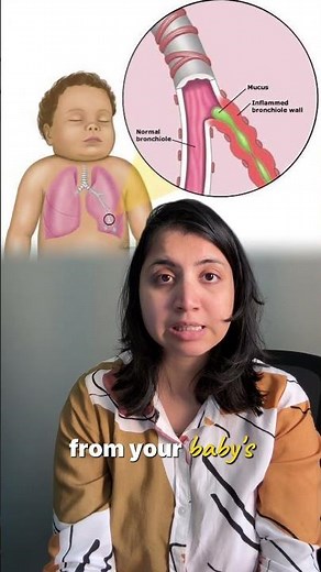 Chest Physiotherapy to Newborn || Explained by a Pediatrician #drjinalgada