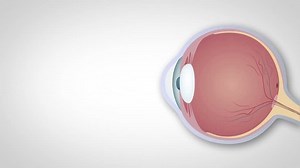 Schematic Representation Hyperopia Myopia Astigmatism Correction Stock Footage Video (100% Royalty-free) 21230203 | Shutterstock
