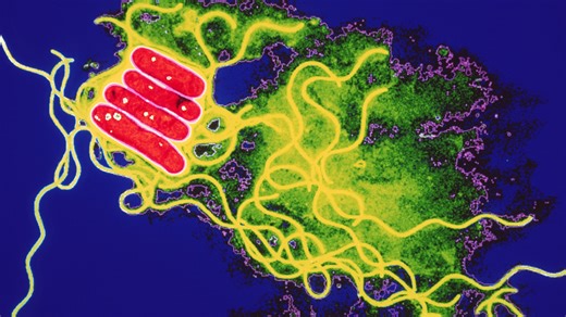 Scots hospital building forced to shut over deadly bacteria in water