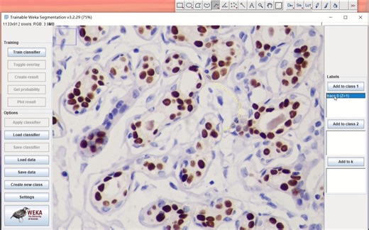Fiji统计免疫组化阳性细胞数