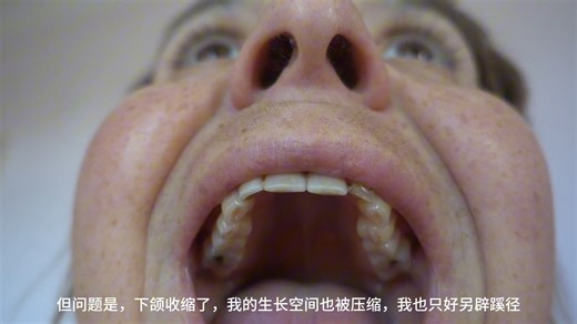 科普视频- 智齿的一生